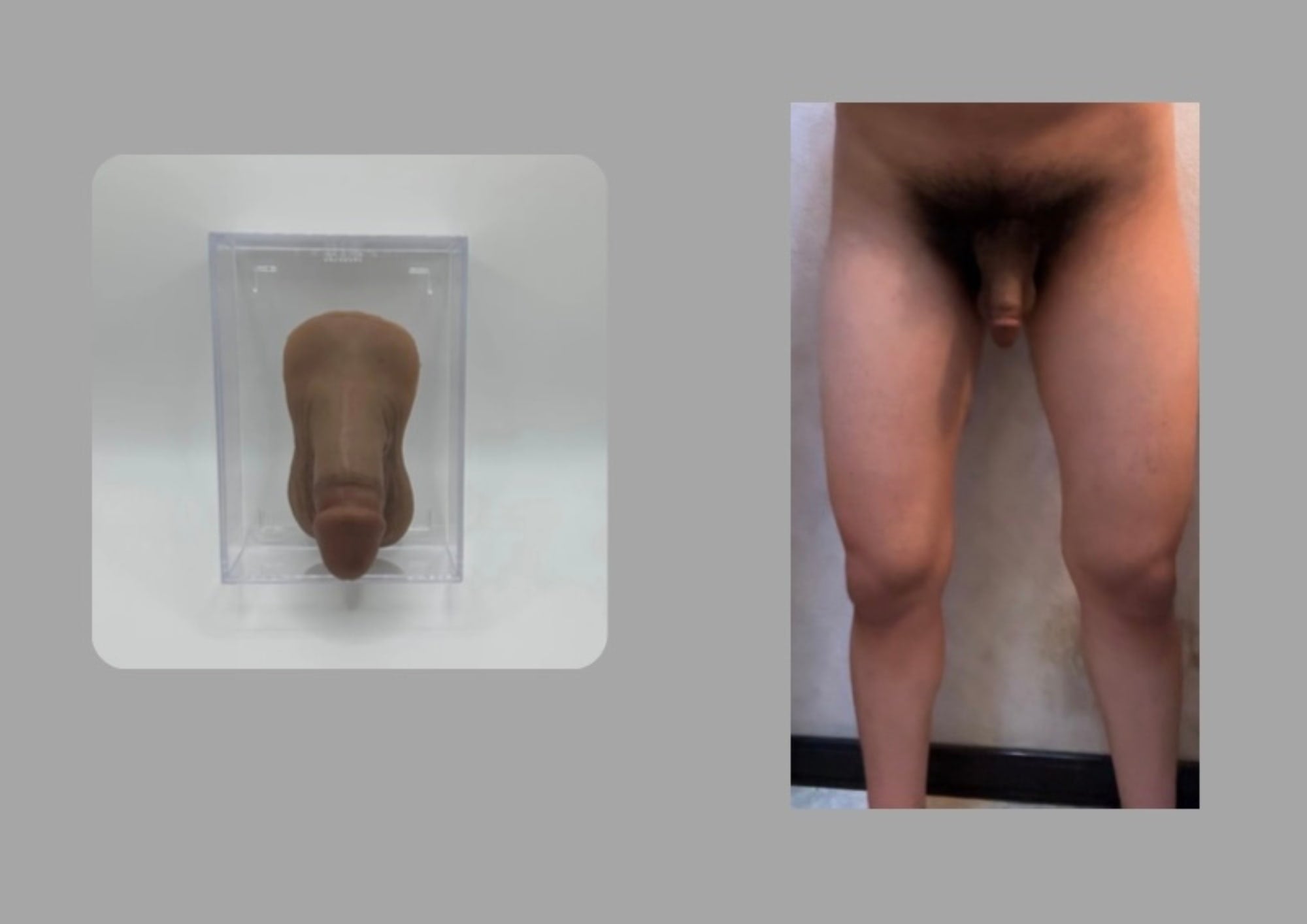 FTM エピテーゼ「Toren Round」黒め 露茎タイプ レギュラーサイズ 陰毛なし 着用イメージ - Wearing image of Toren Round FTM prosthetic, circumcised, regular size, darker tone, without pubic hair.